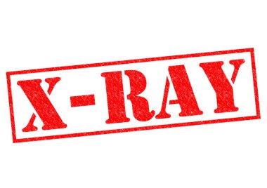 x-ışını lastik damgası