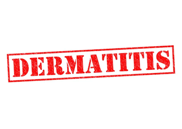 Dermatite — Foto Stock