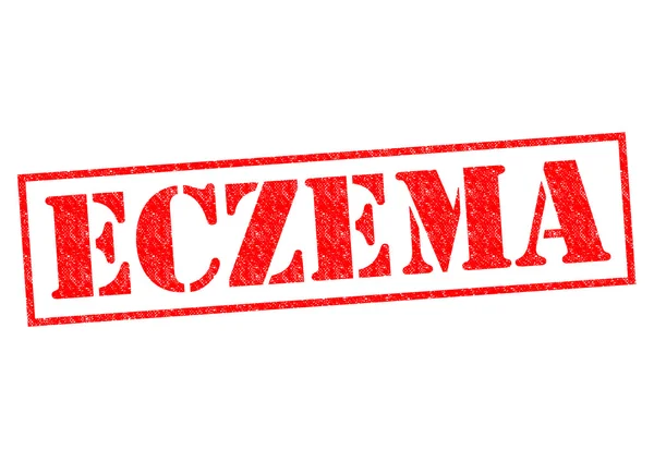 ECZEMA — Stock Photo, Image