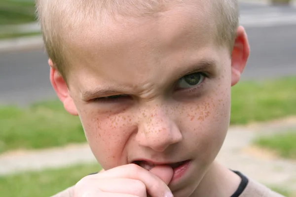 Boy Biting Thumb — Stock Photo, Image