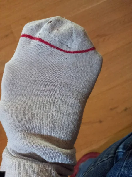 Сміливий Шкарпетка Використовуючи Техніку Ремонту Голкою Ниткою Щоб Покрити Отвір — стокове фото