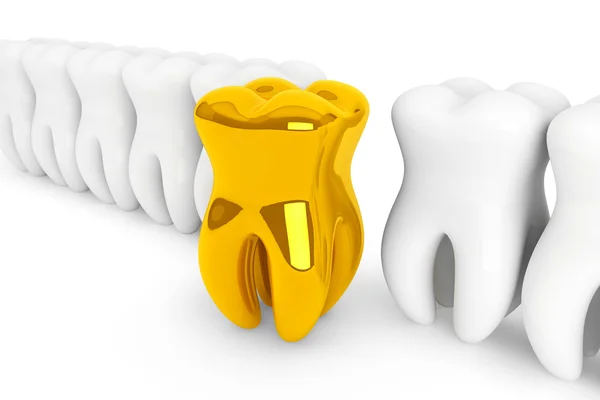 Extreme closeup gold tooth — Stock Photo, Image