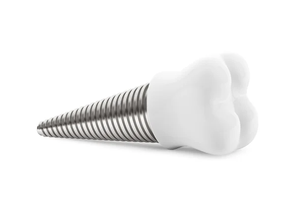 Dental concept. Tooth Implant — Stock Photo, Image