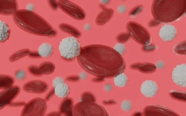Görs Medicinskt Korrekt Illustration För Många Vita Blodkroppar Grund Leukemi — Stockfoto