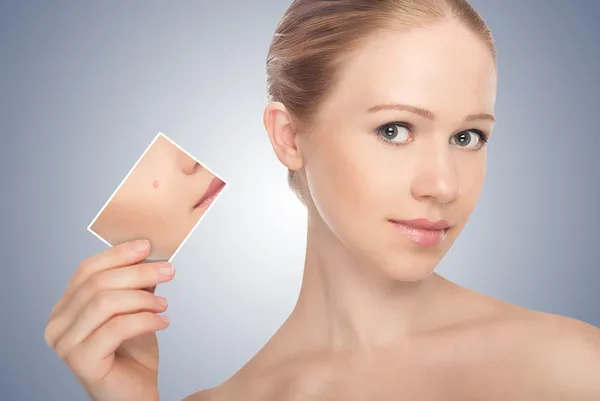 Concepto cuidado de la piel. Piel de mujer joven belleza antes y después t —  Fotos de Stock