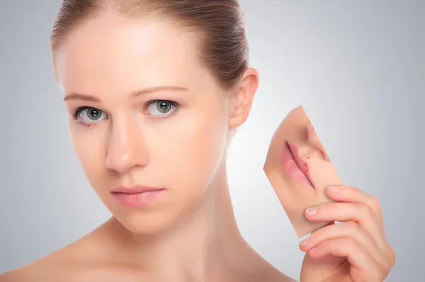 Begreppet hudvård. hud skönhet ung kvinna med herpes på läppen — Stockfoto