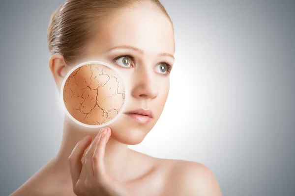 Concetto di cura della pelle cosmetica. volto di giovane donna con sci secco — Foto Stock
