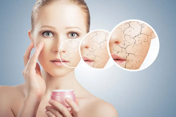 Concept of cosmetic skin care. face of young woman with dry ski — Stock Photo, Image