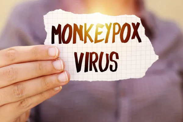 Maymun Çiçeği (bulaşıcı hastalık) teşhisi konulmuş, elinde gözyaşı kağıdı tutan yakın plan kadın. 