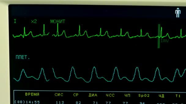 病院での手術。行動だ。40代の男がソファに寝そべって手術室に連れて行かれ心臓の鼓動がチェックされる — ストック動画