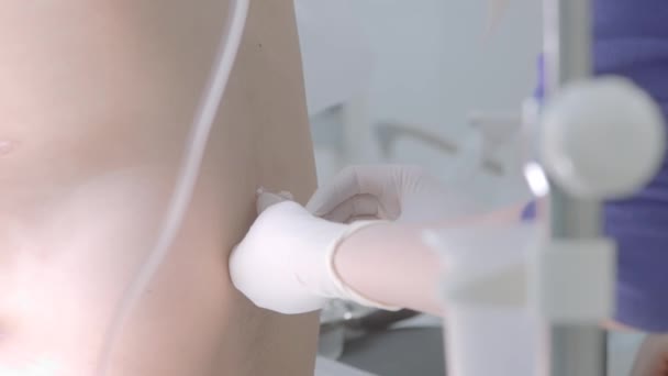 A deréktáji szúrás folyamatának lezárása. Felvétel. Egy orvos, aki gerincvelőszúrást végez a kórházban.. — Stock videók