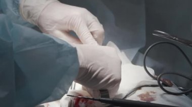 Cerrahların elleri ameliyat sırasında yakınlaşır. Başla. Cerrahların elleri ve asistanları hastayı ameliyat eder. Hasarlı veya enfekte olmuş organ ameliyatı. 