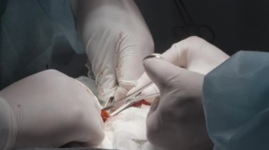 Cerrahi operasyon. Başla. Ameliyat için kesilen cerrahi cımbız, kan ve organlarla ameliyat yapan genç uzmanlar görülebilir. Yüksek kalite 4k görüntü