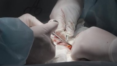 Bir cerrah ve asistanının işi. Eylem. İki hastane çalışanı neşter, kan, organ ve bandajla karmaşık bir ameliyat yapıyor. Yüksek kalite 4k görüntü