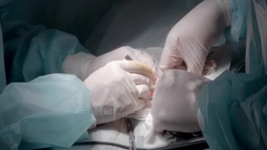 Cerrahların elleri ameliyat sırasında yakınlaşır. Başla. Cerrahların elleri ve asistanları hastayı ameliyat eder. Hasarlı veya enfekte olmuş organ ameliyatı. 