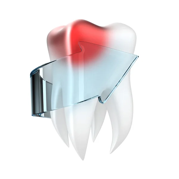 Dente umano — Foto Stock