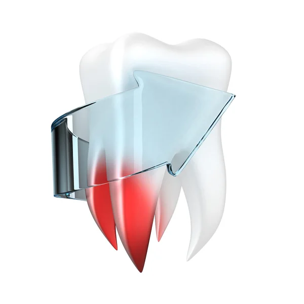 Mänsklig tand — Stockfoto
