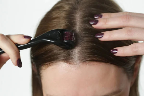 Γυναίκα Που Χρησιμοποιεί Ρολό Microneedle Δέρμα Στο Κεφάλι Για Την — Φωτογραφία Αρχείου