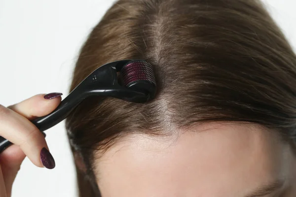 新しい髪の成長を刺激するために頭の上にマイクロニードルデルマローラーを使用して女性 健康的な頭皮のためのシンプルで安価な治療 — ストック写真