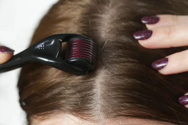 Mujer Que Utiliza Microneedle Derma Roller Cabeza Para Estimular Nuevo —  Fotos de Stock