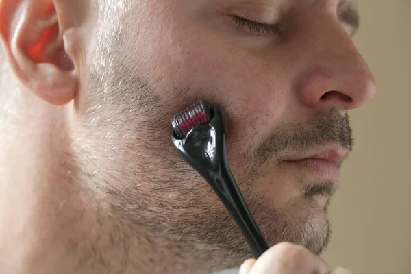 Gesichtsmassage Mit Mikronadeln Dermaroller Zur Behandlung Von Narben Falten Und — Stockfoto