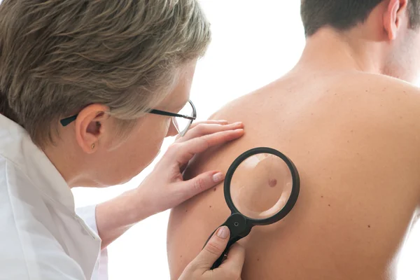 Dermatologista examina uma toupeira — Fotografia de Stock