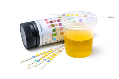 idrar test şeritleri