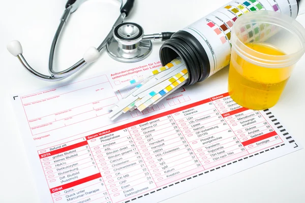 Urine test strips — Stock Photo, Image