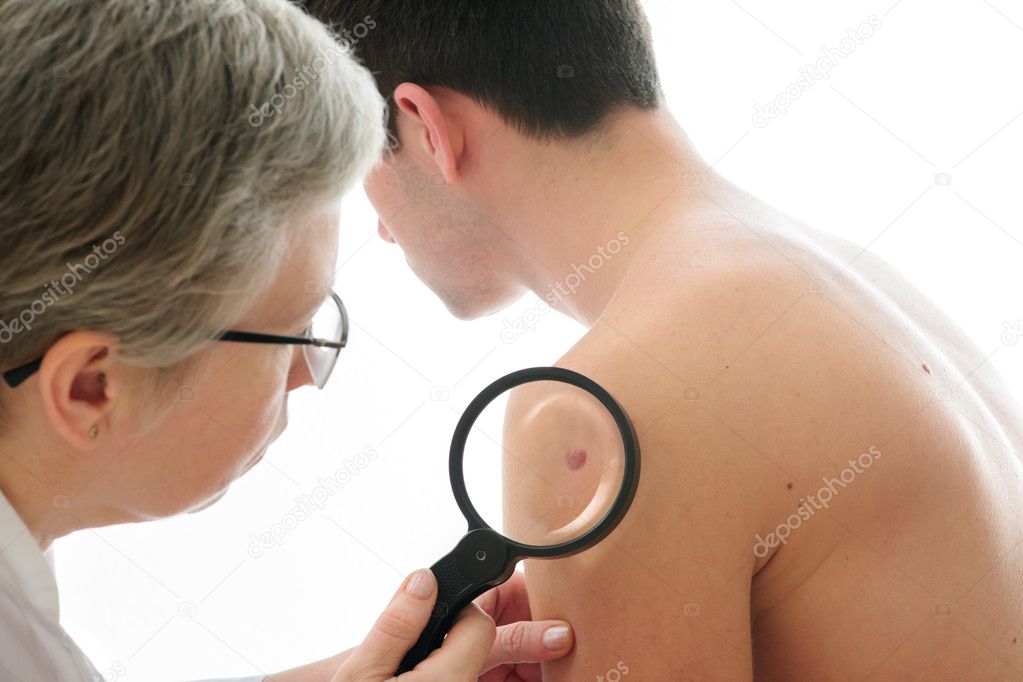 Dermatologist examines a mole