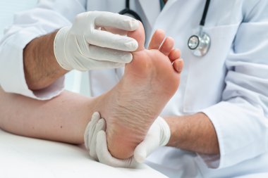 Tinia pedis veya atlet ayak