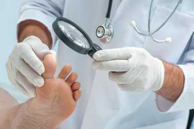 Tinia pedis veya atlet ayak