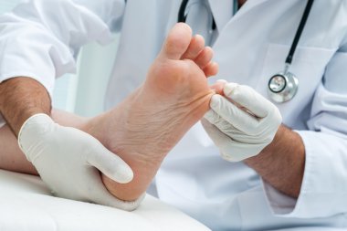Tinia pedis veya atlet ayak