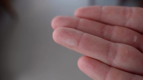 手の近くの指に液体でカラスブリスターぼやけた背景に 過度の圧力と手の摩擦の結果 手袋なしで働く男の手 高品質4K — ストック動画
