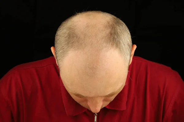 Bald Head White European Man — Stockfoto