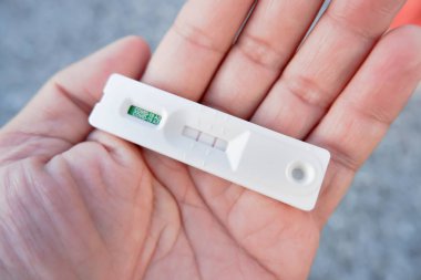İnsan eli hızlı bir antijen test kitinden (ATK) bir Covid-19 pozitif sonuç kaseti gösterir)