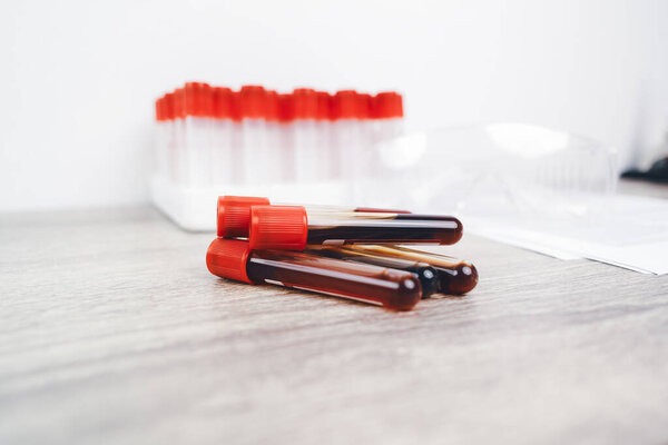A blood test sample tube pile with a red cap on desk in the hematology lab,  hematology healthcare laboratory concept