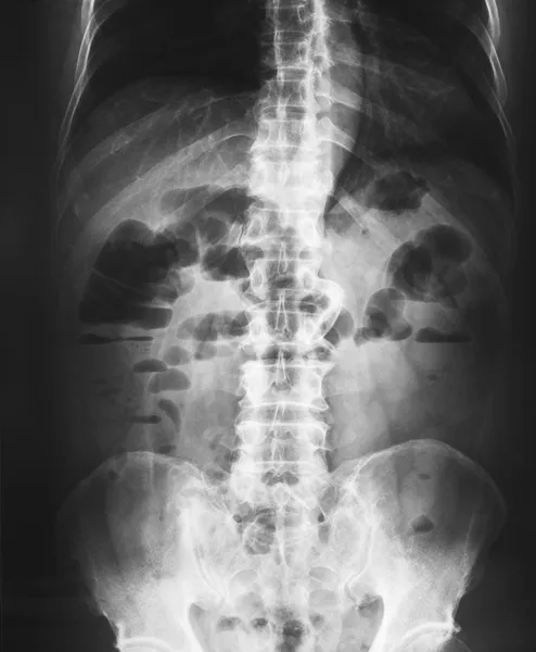 骨盆和脊柱的 x 射线 — 图库照片