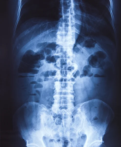 Radiografía de la pelvis y la columna vertebral —  Fotos de Stock