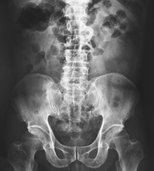 Radiografia da pelve e coluna vertebral — Fotografia de Stock