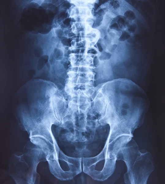 Рентген таза и позвоночника Стоковое Фото