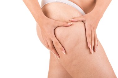Woman showing her cellulite clipart