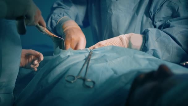 Close Shot Male Doctor Wearing Glasses Scrubs Operating Patients Stomach — Stok video
