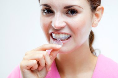 Teeth whitening, woman with tooth tray clipart