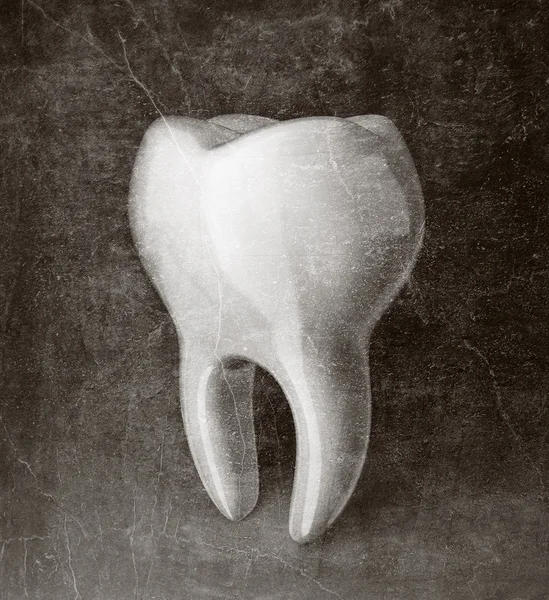 Tooth — Stock Photo, Image