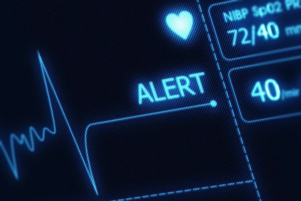 EKG uyarı illüstrasyon
