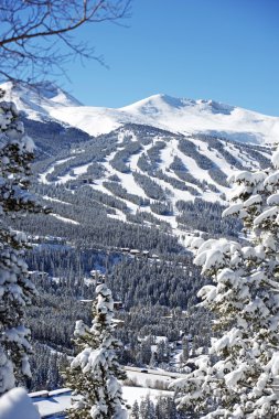ünlü breckenridge