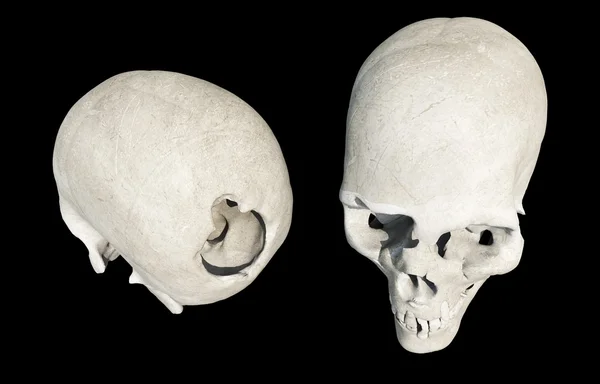 Cranio danneggiato isolato su nero — Foto Stock