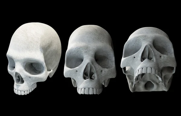 黒の上の人間の頭骨 — ストック写真