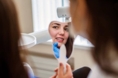 Ortodontist, teli ayarladıktan sonra genç kızın diş tellerini kontrol etmesi için aynayı tutuyor. Kadın aynaya bakar, ağzını açar ve dişine bakar. Diş sağlığı kliniğinde ağız sağlığı tedavisi.