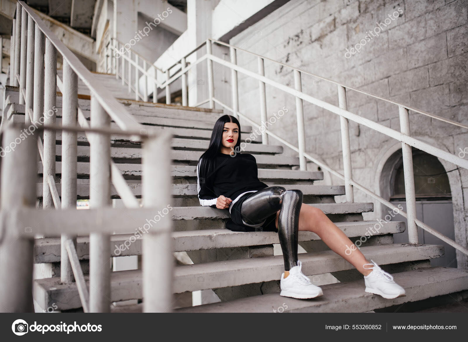 Beautiful Woman With Prosthesis Leg Stock Photo - Download Image